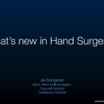 What’s new in hand surgery